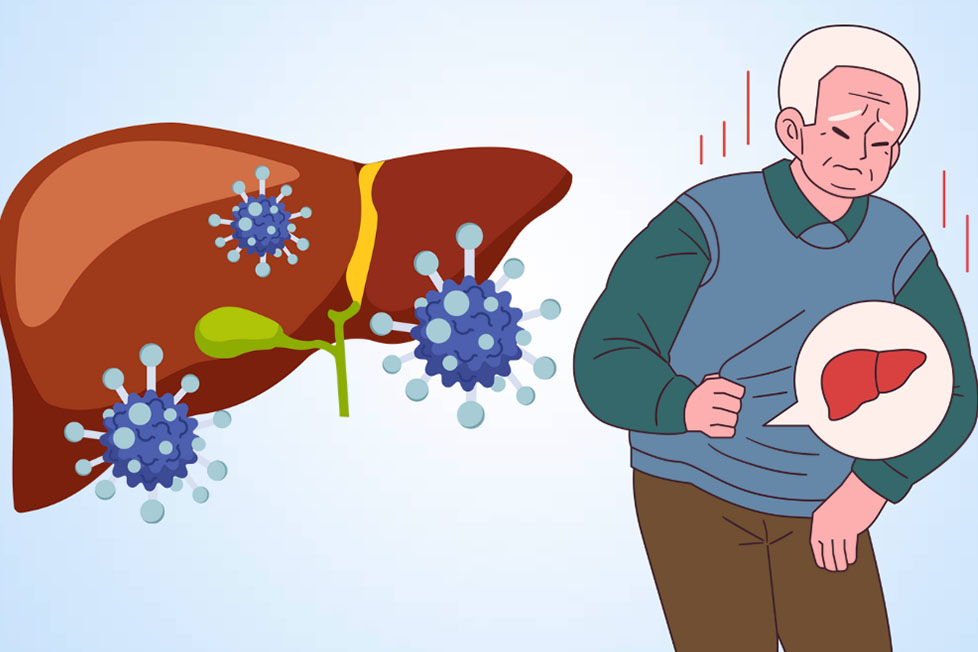 B型肝炎とC型肝炎の違い。グラフィック:Thien Nhan