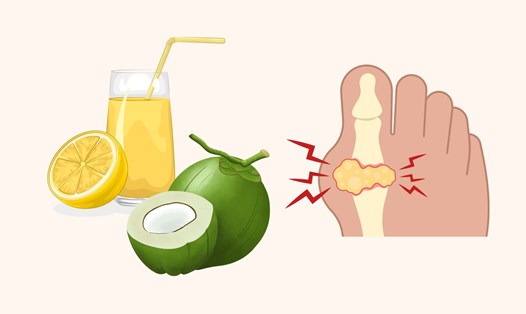 Nước dừa tươi là nguồn cung cấp khoáng chất quý giá hỗ trợ đào thải acid uric tự nhiên.