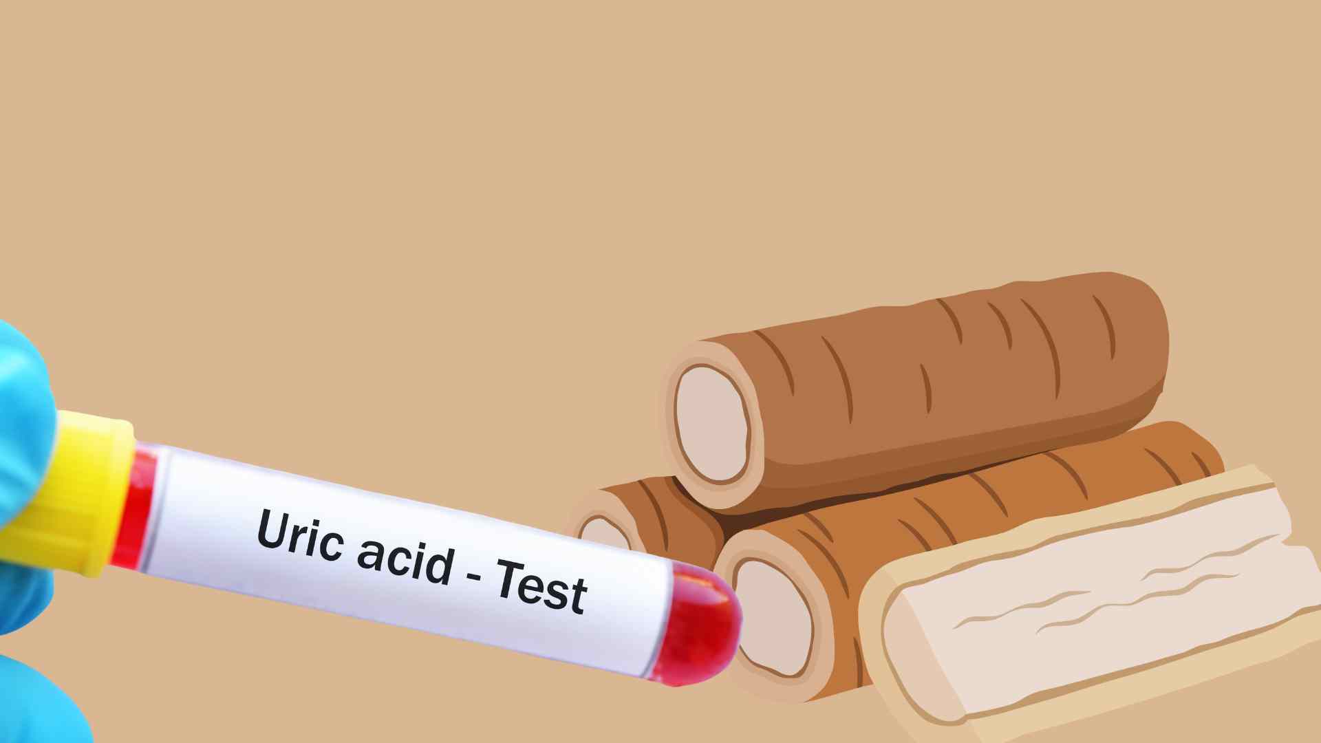 Bay leaves have the effect of preventing uric acid spikes. Graphic photo: Huong Giang