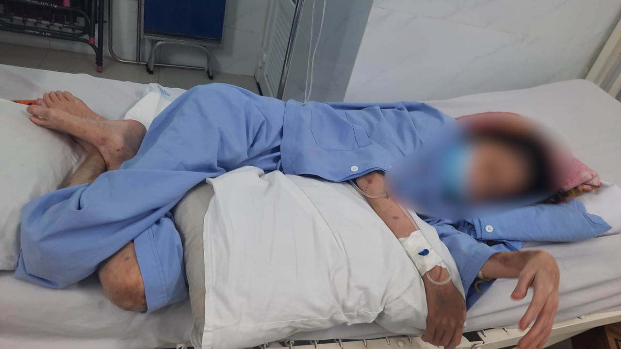 腎不全患者は生涯透析を受けなければならない。写真:Nguyen Ly