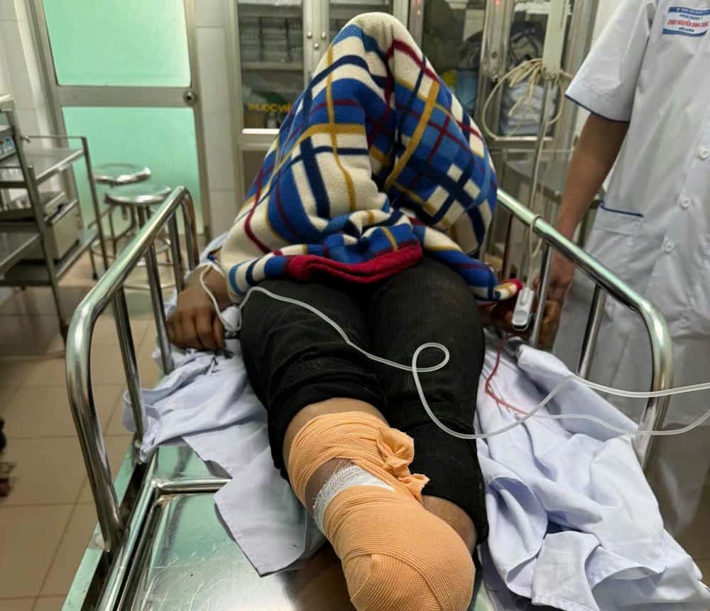 눈 사고 후 의사들은 환자를 치료하기 위해 눈을 적극적으로 치료하고 있습니다. 사진: 병원 제공