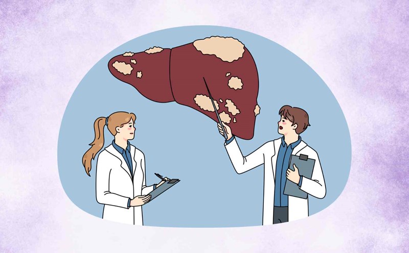 How to detoxify the liver continuously through drugs and alcohol. Graphic photo: Thai Anh