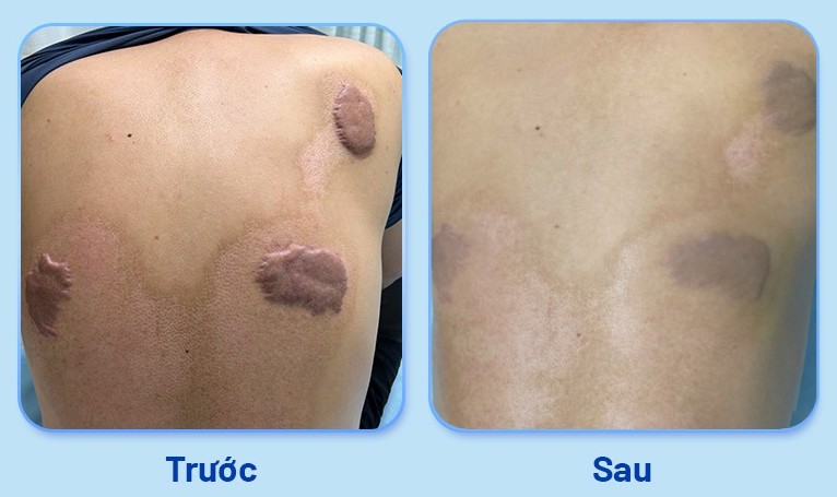 患者の治療前と治療後における腫れ。写真:病院提供