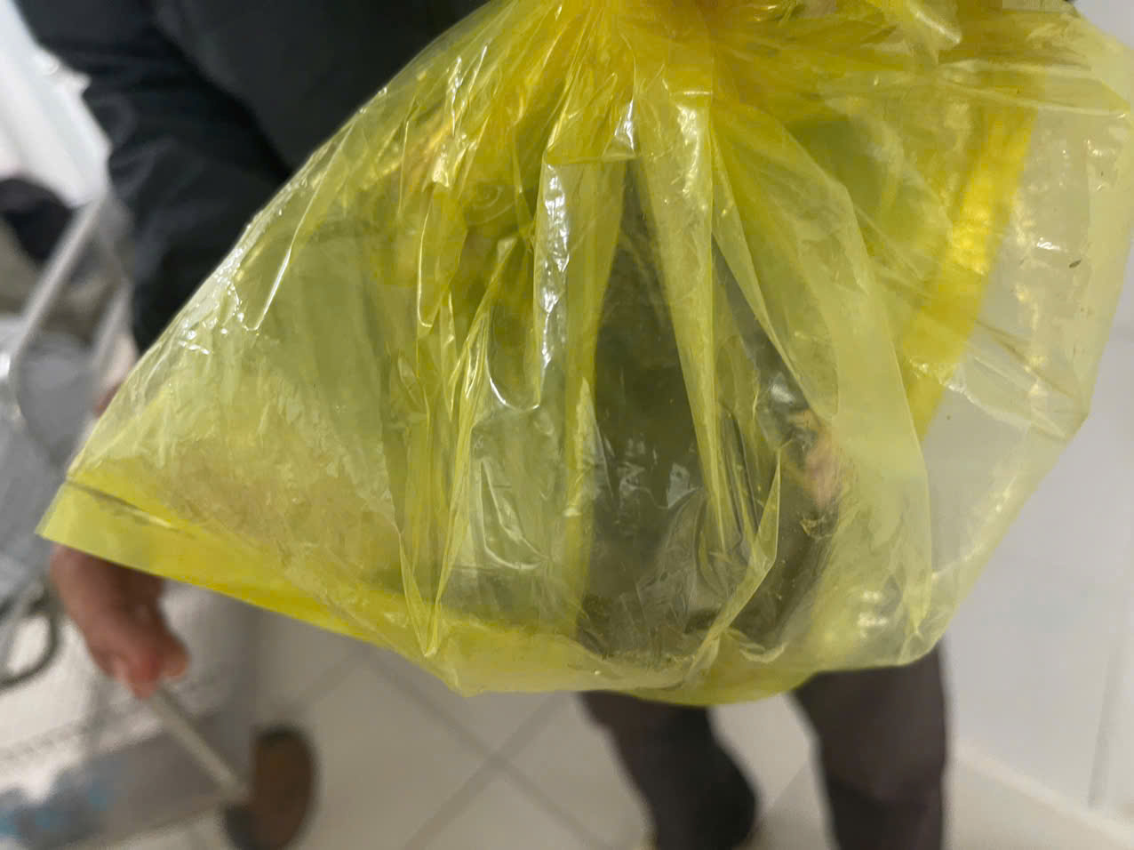 銅採掘中の男性の尿道に約8cmのクマが侵入。写真:Dong Nai総合病院提供