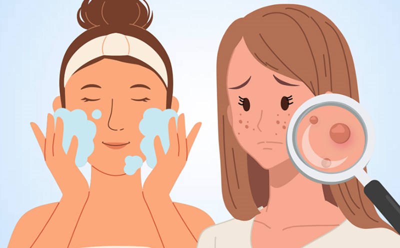 Washing your face incorrectly can be harmful to your skin. Graphics: Thien Nhan