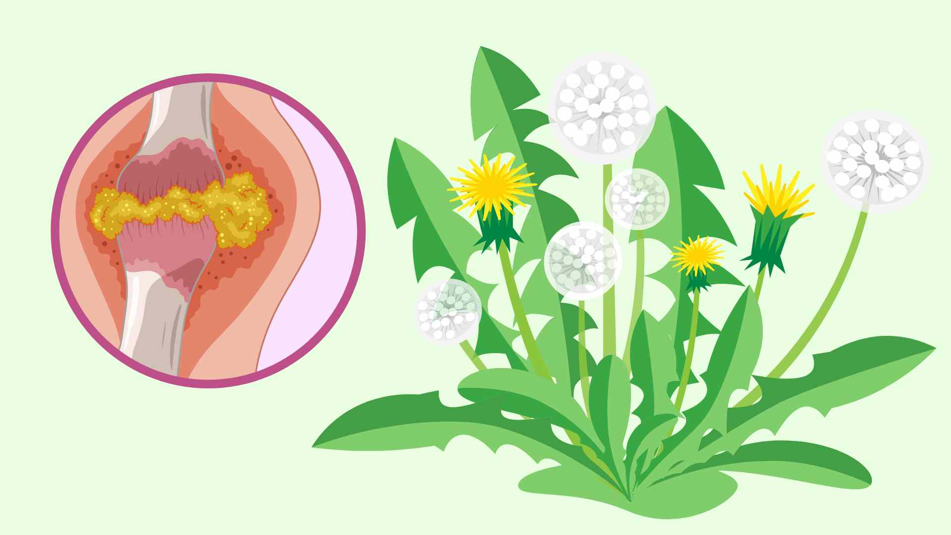 Dandelion leaves help eliminate uric acid effectively. Graphic photo: Huong Giang