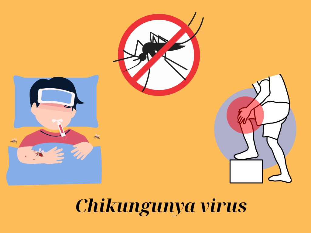 The key to distinguishing signs of Chikungunya from dengue fever. Graphic photo: Huong Giang