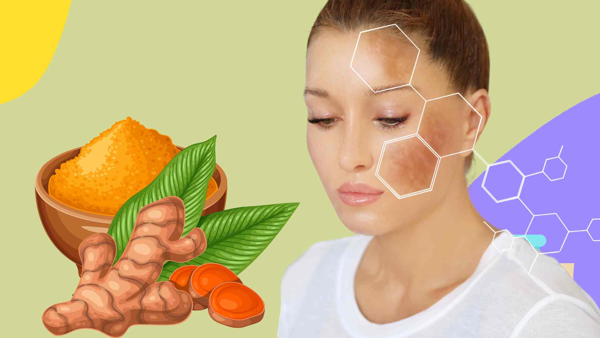 3 quick tips to treat melasma from natural ingredients. Graphic photo: Hoang Loc