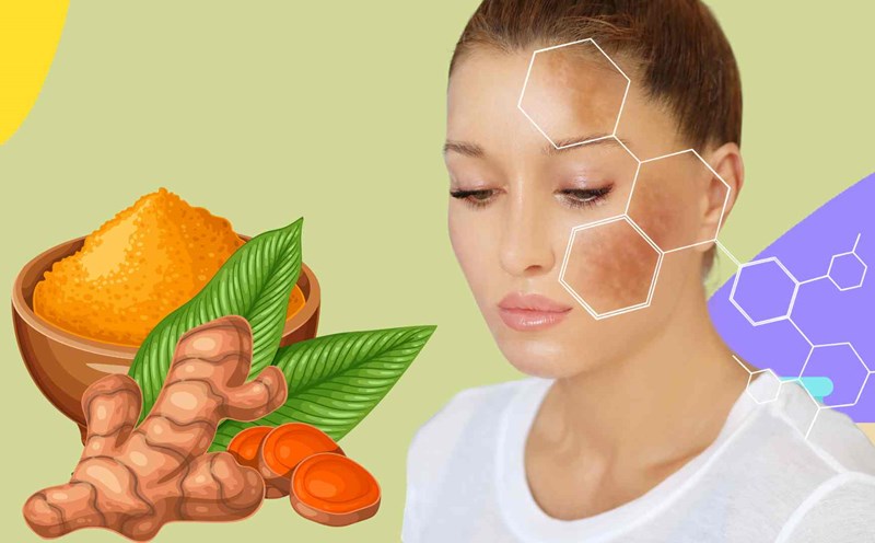 3 quick tips to treat melasma from natural ingredients. Graphic photo: Hoang Loc
