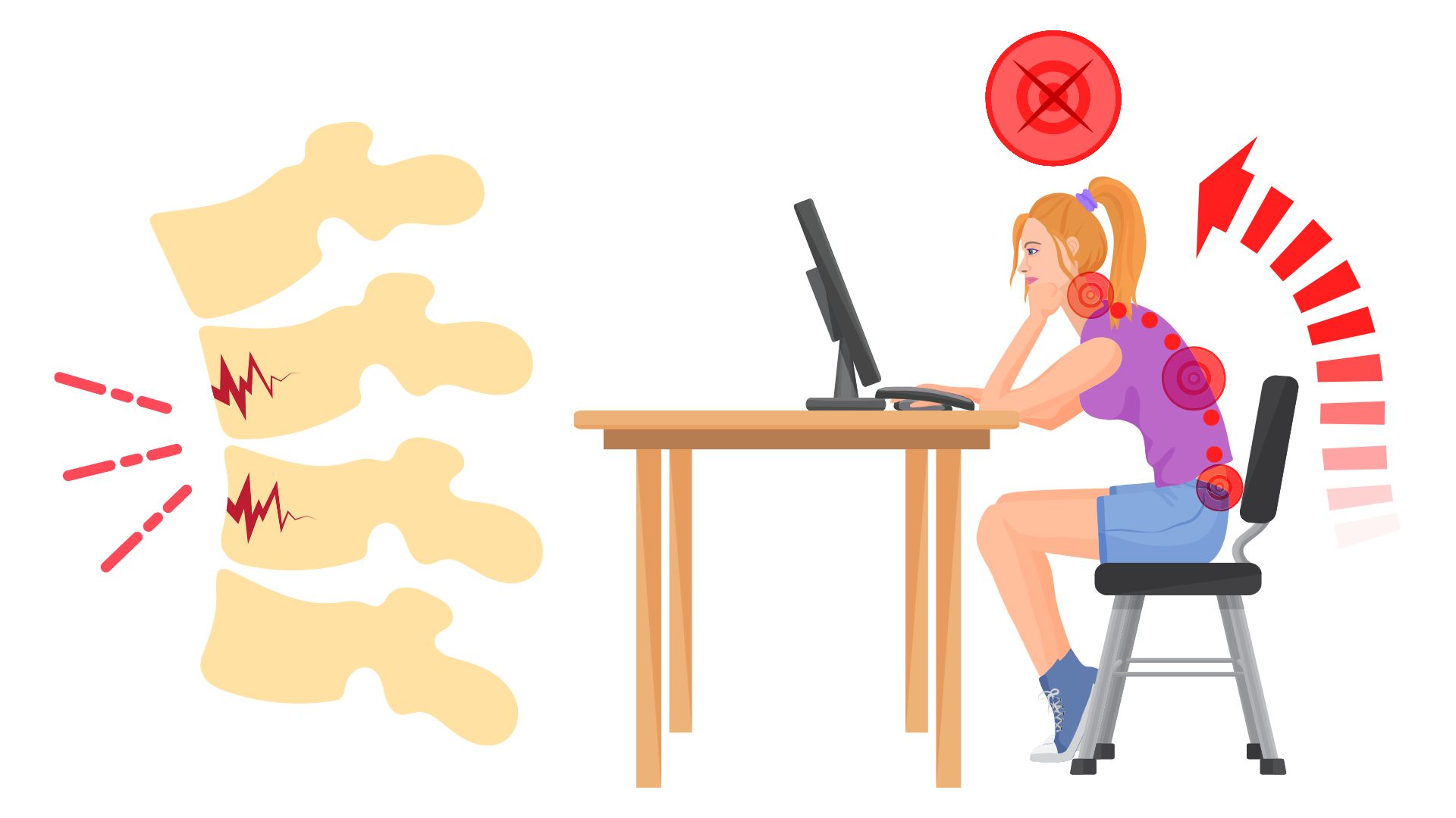 The habit of sitting with a slouching position is associated with lower back pain. Graphics: Thanh Thanh