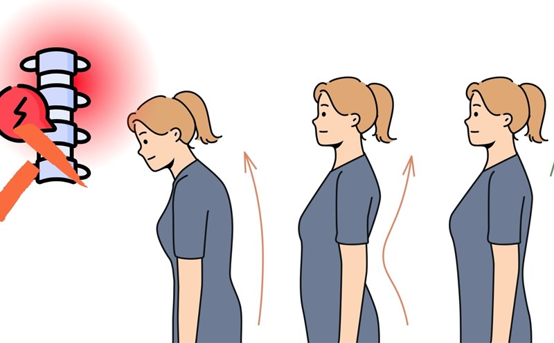 Maintaining the correct posture when walking or sitting helps reduce the risk of back pain. Graphics: Thanh Thanh