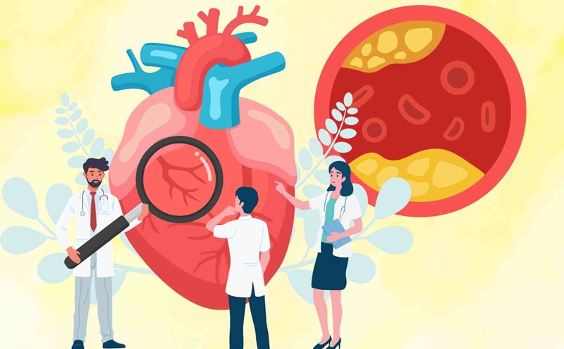 Familiar foods help control blood fat, protect the cardiovascular system that few people pay attention to