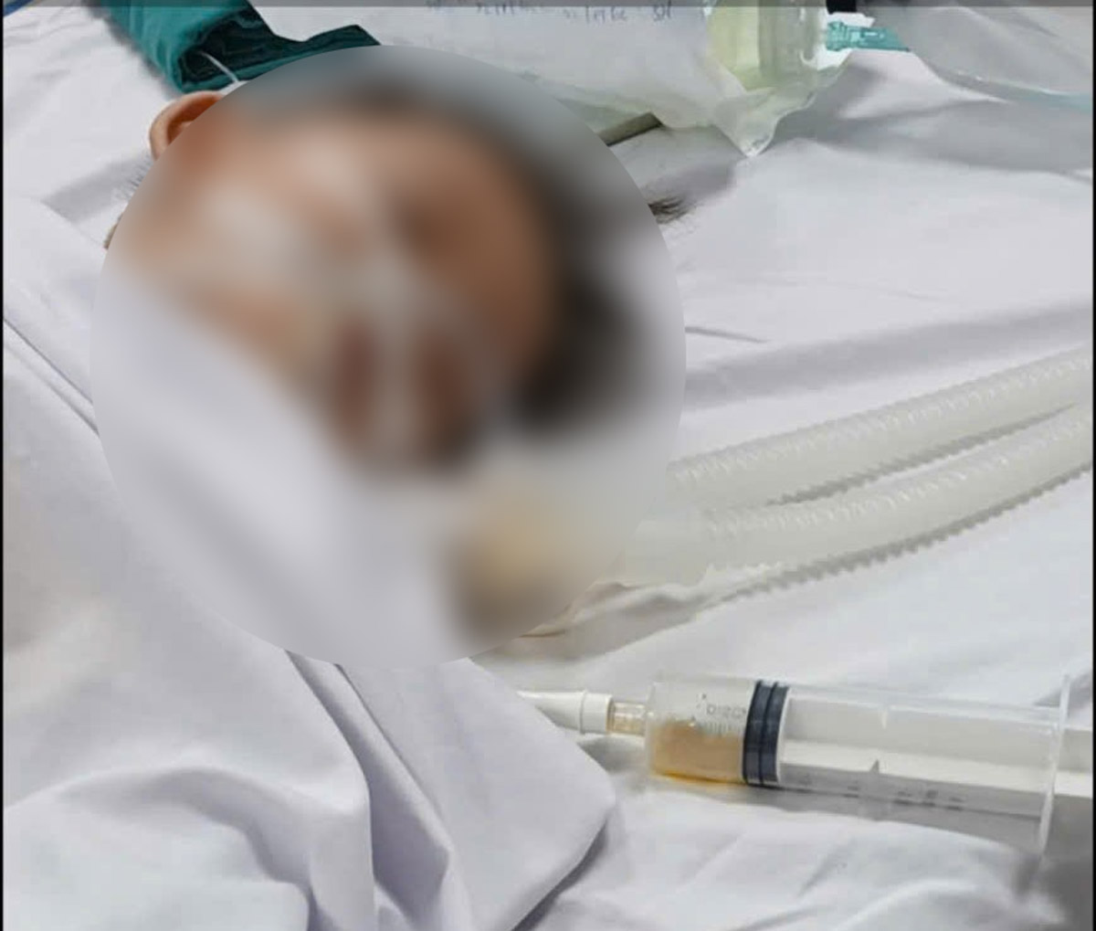 Thuy Nguyen General Hospital (Hai Phong City) saved an 18-month-old boy who drowned. Photo: Thuy Nguyen General Hospital