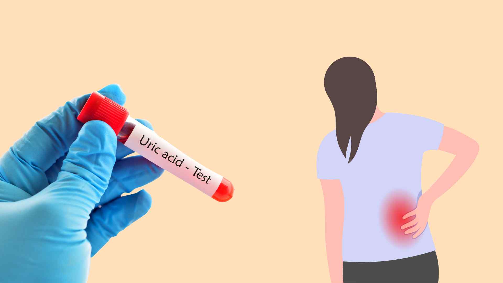 Many young people suddenly discovered that uric acid index increased. Graphic photo: Hoang Loc