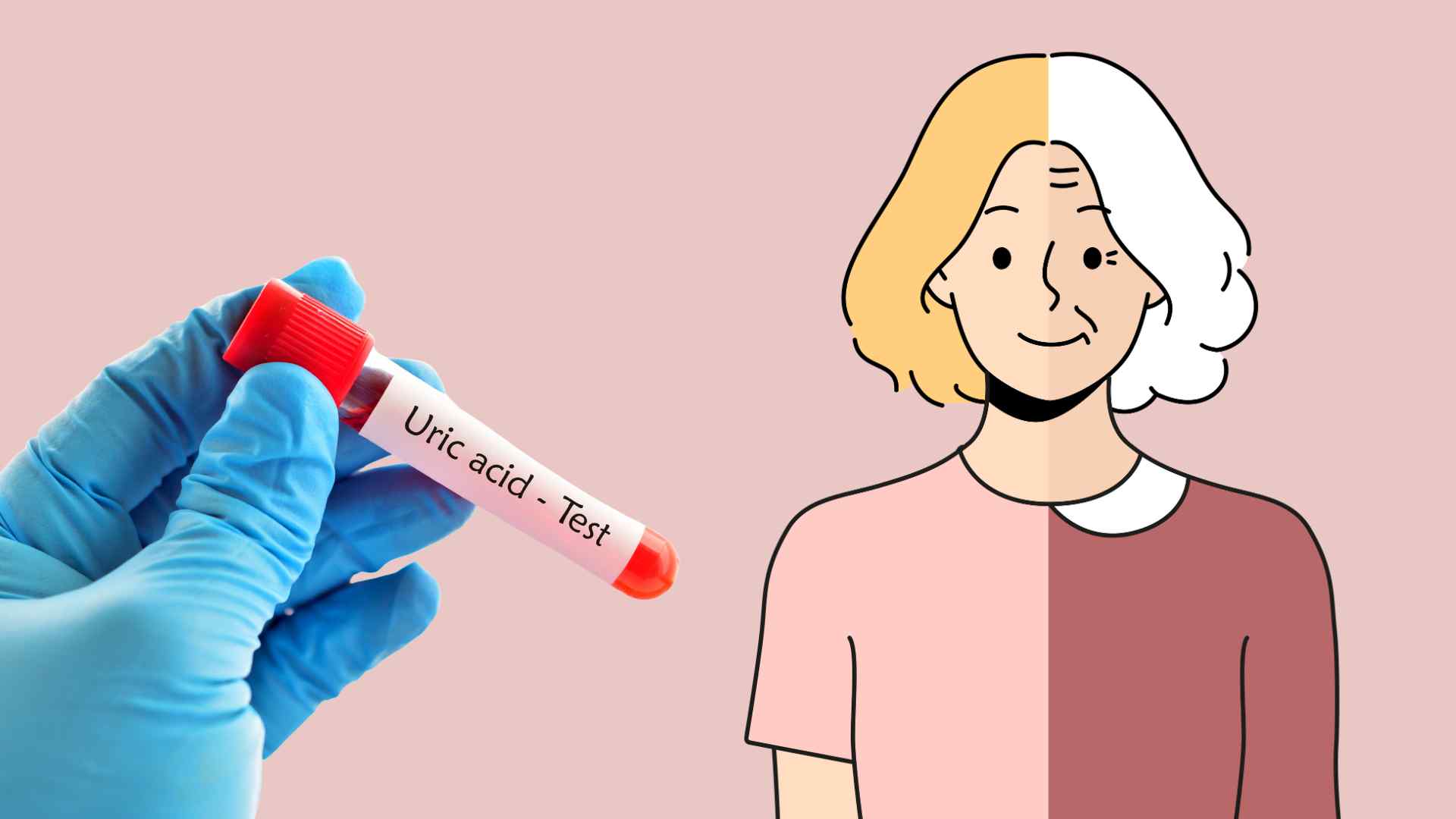 Middle-aged women are more likely to increase uric acid. Graphic photo: Thai Anh