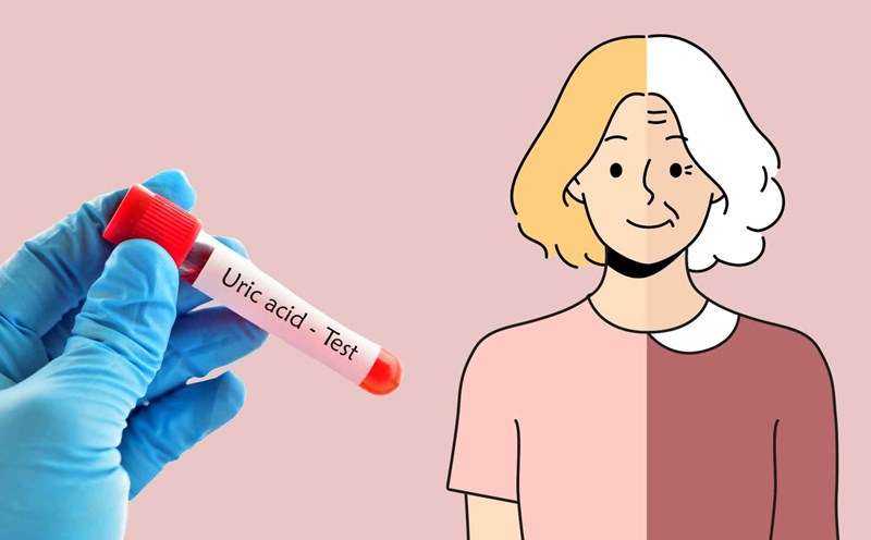 Middle-aged women are more likely to increase uric acid. Graphic photo: Thai Anh