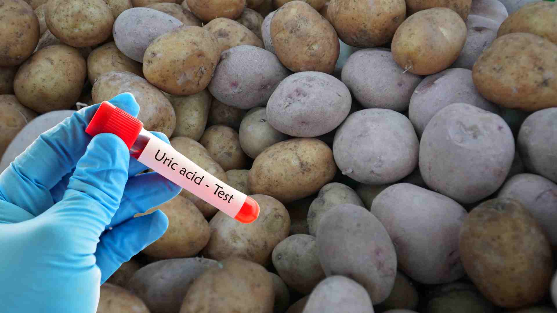 Potatoes help reduce uric acid. Photo: Ha May