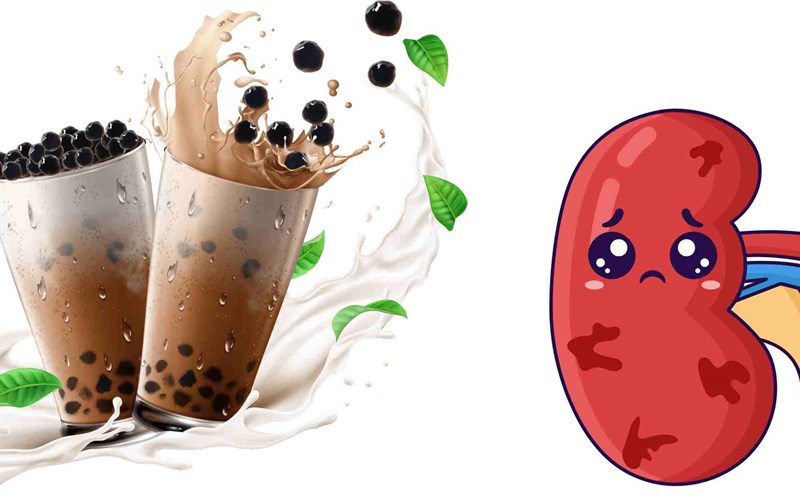Drinking milk tea can damage the kidneys. Graphics: Ha May