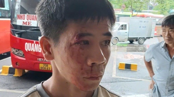 Phụ xe bất ngờ bị đánh túi bụi tại bến xe Giáp Bát