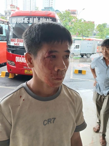 Phu xe bi danh gay thuong tich tai ben xe Giap Bat. Anh: Nhan vat cung cap