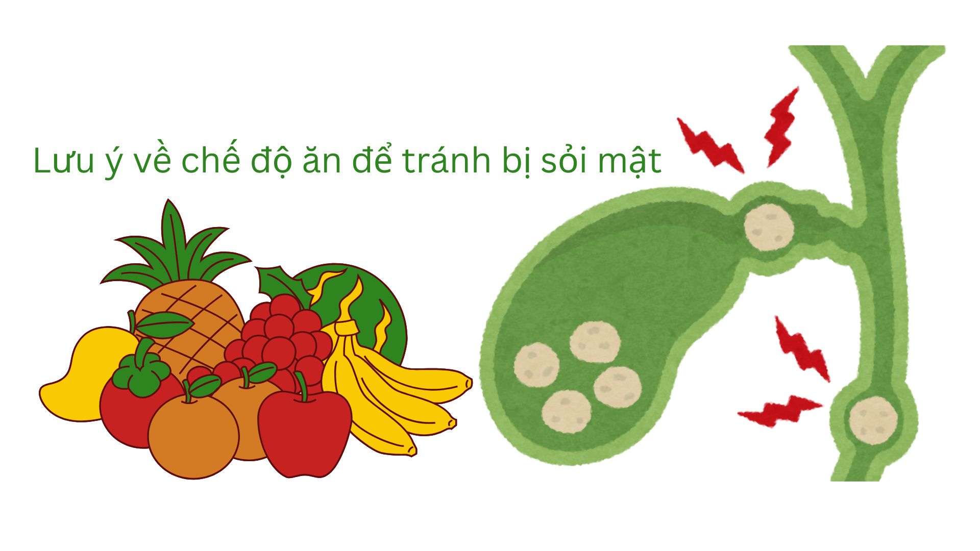 Preventing gallstones through diet requires adhering to a healthy, balanced diet. Graphics: Thuc Quyen