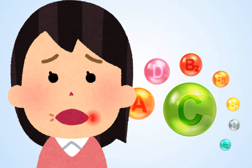 Causes and solutions for canker sores caused by vitamin deficiency. Graphics: Thien Nhan