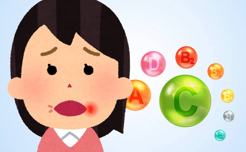 Causes and solutions for canker sores caused by vitamin deficiency. Graphics: Thien Nhan
