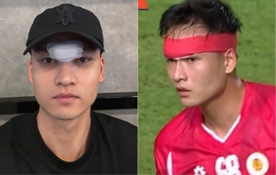 Center back Bui Hoang Viet Anh (Hanoi Police) strokes 14 strokes in the forehead area. Photo: Cut from video