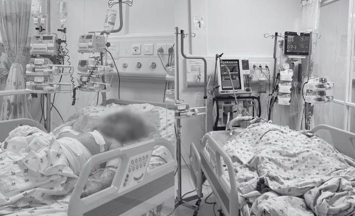 The two sisters were hospitalized in critical condition due to arson. Photo: Provided by the hospital