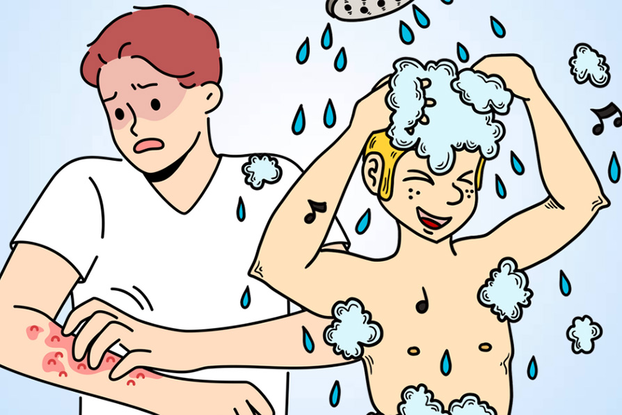 Causes and treatments for itchy skin after bathing. Graphics: Thien Nhan