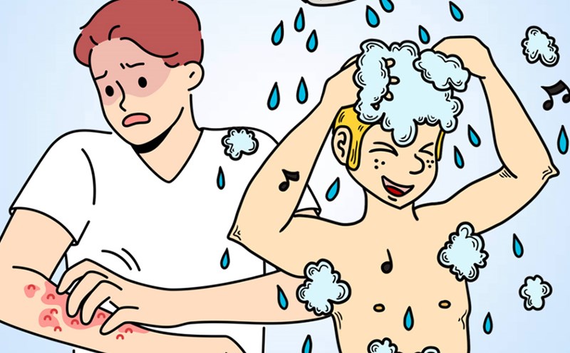 Causes and treatments for itchy skin after bathing. Graphics: Thien Nhan