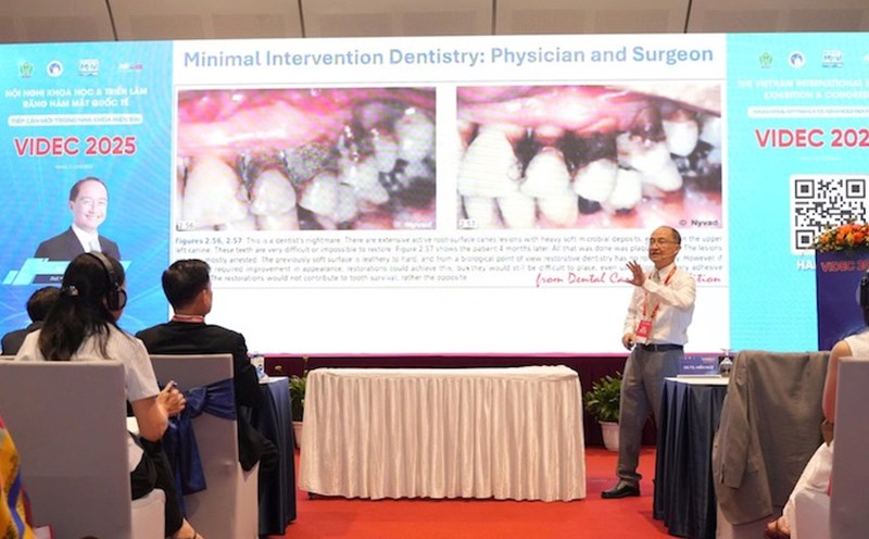 Dental and maxillofacial experts report at theVIDEC 2025 scientific conference - a specialized conference on oral health. Photo: Thuy Linh
