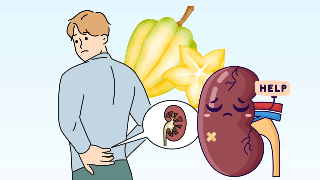 Sweet and sour fruits that kidney patients should stay away from