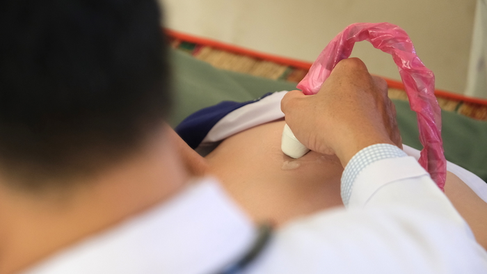 Un examen et un depistage gratuits du cœur congenital pour des centaines d'enfants a Can Tho