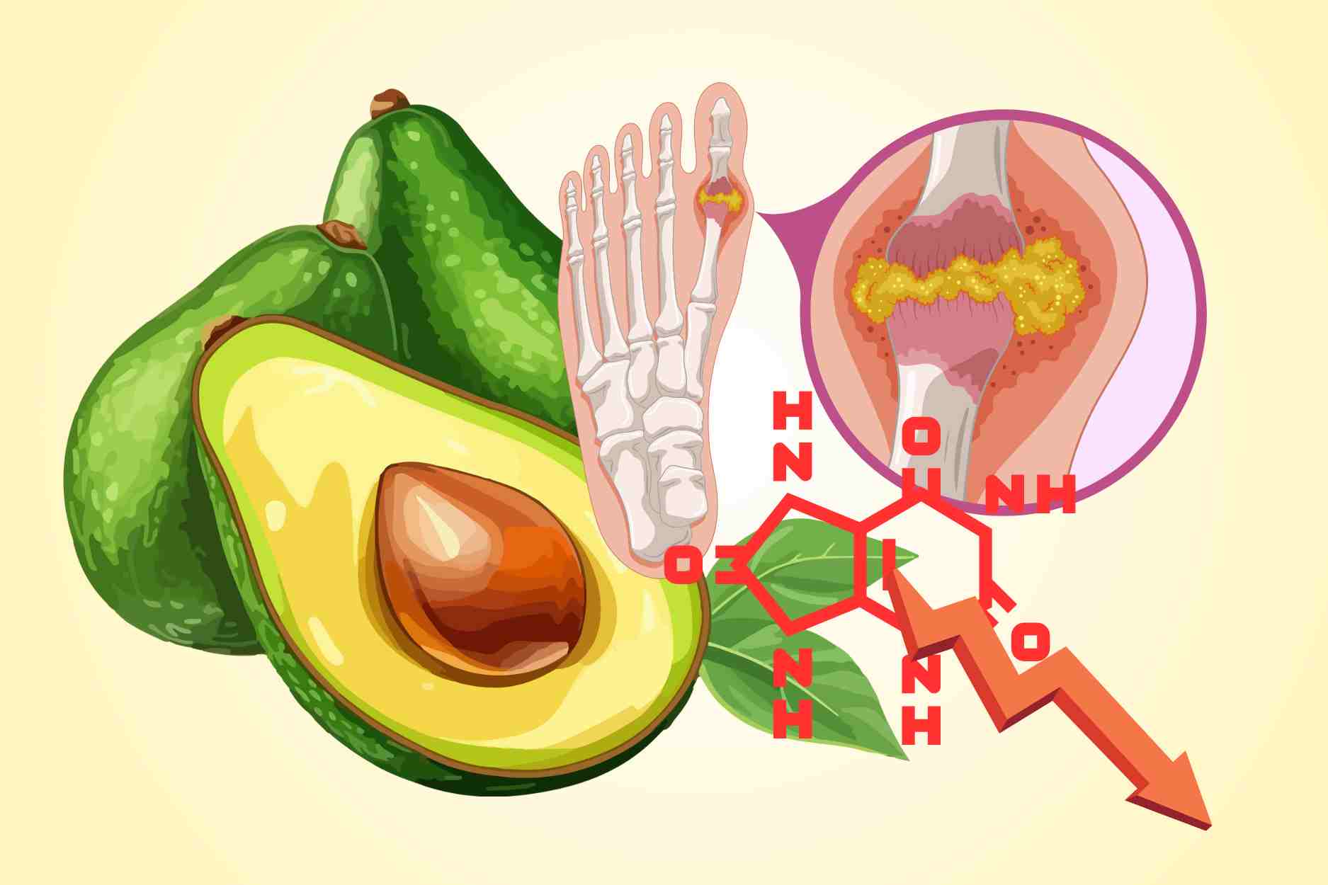 The golden time to eat avocado is to help lower uric acid most effectively