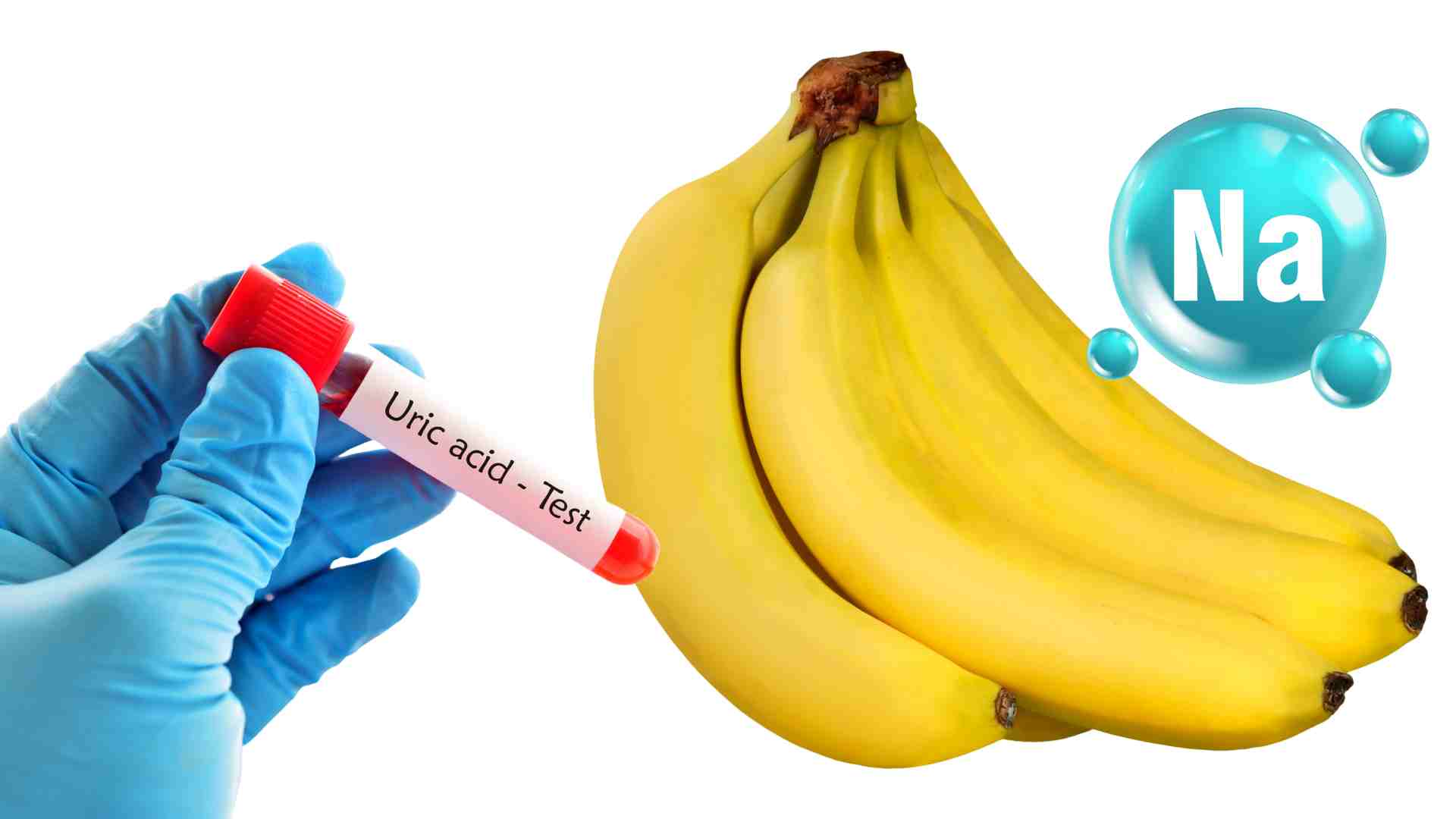 Eating bananas in moderation can help reduce uric acid. Graphics: Ha May