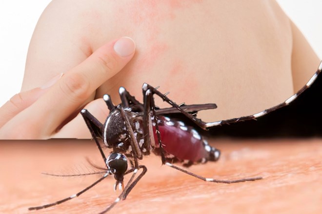 Effective measures to avoid mosquitoes in this rainy weather. Graphics: Thien Nhan