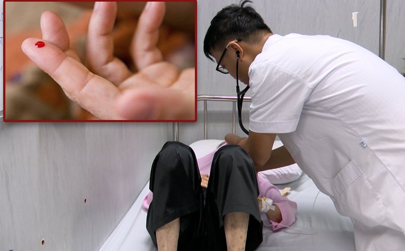 Warning about the situation of blood extraction for fingertips to prevent stroke from "virtual doctors"
