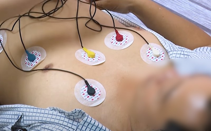 The patient can have Holter measurements to assess his heart condition. Photo: Provided by the hospital