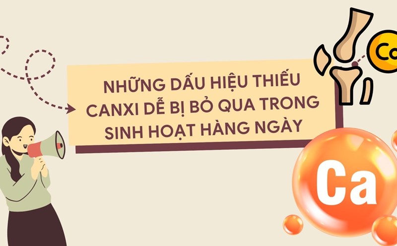 Lack of calcium can easily lead to cramps, brittle nails... Photo: Huong Son