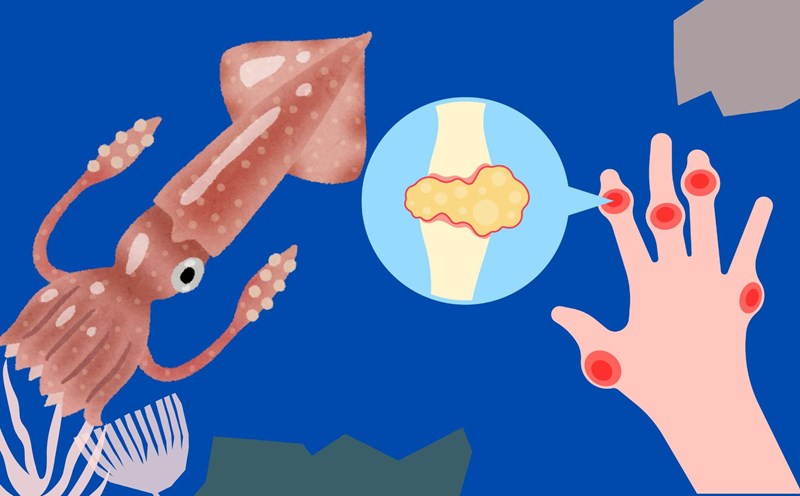 Eating squid properly such as steaming, boiling in moderation will be good for people with high uric acid. Graphic photo: Huong Son