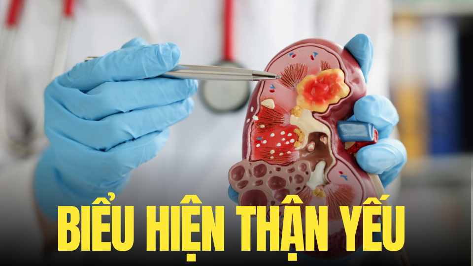 Early detection and recognition of signs of early kidney failure is very necessary. Graphics: Tra My