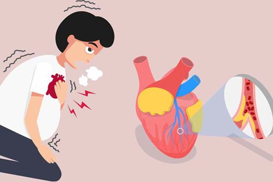 These are important signs to help you distinguish between a heart attack and cardiac arrest. Graphics: Thai Anh