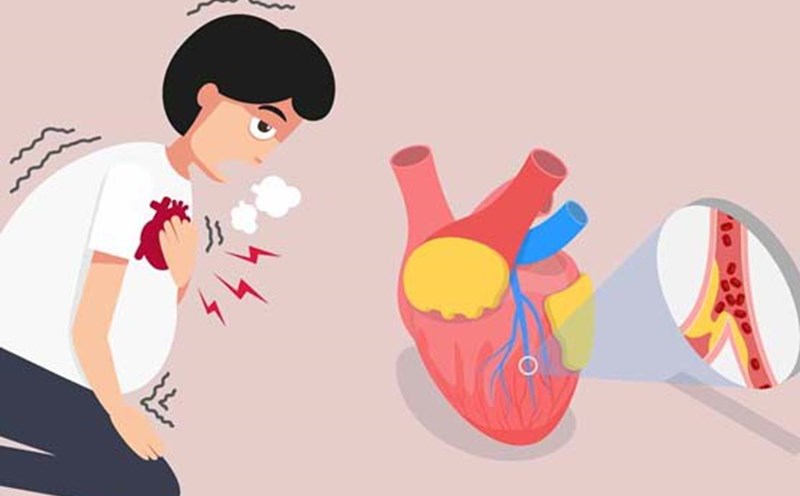 These are important signs to help you distinguish between a heart attack and cardiac arrest. Graphics: Thai Anh