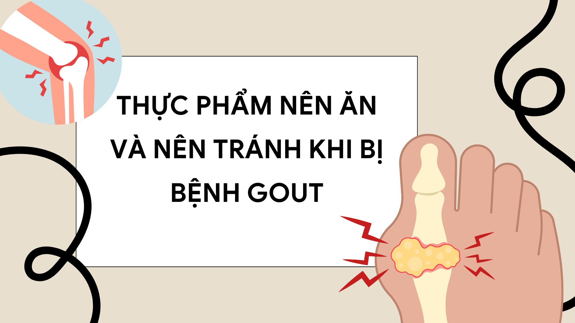 Gout is a painful form of arthritis that requires a scientific diet. Graphic photo: Huong Son