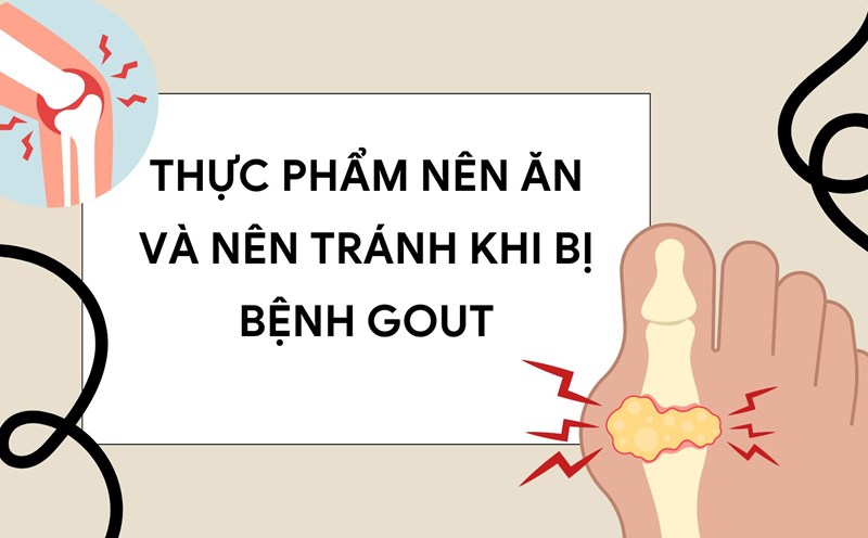 Gout is a painful form of arthritis that requires a scientific diet. Graphic photo: Huong Son