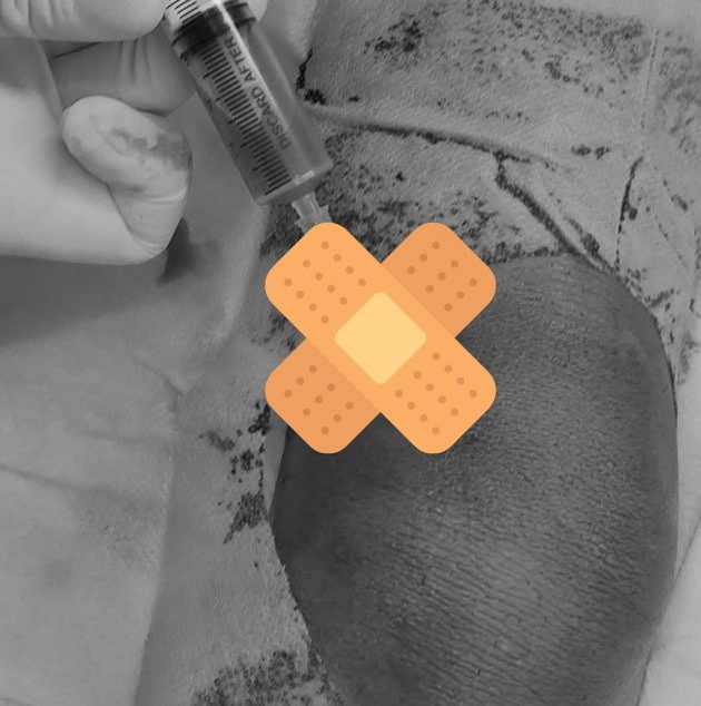 A minor injury left the 6-year-old in critical condition. Photo: BVCC