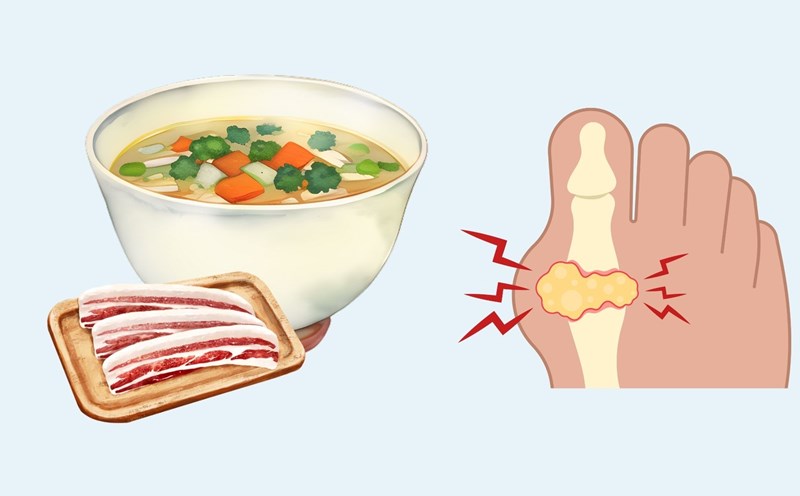 Overusing bone broth can easily increase uric acid. Graphics: Linh Dan
