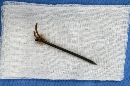 The foreign object was a 5cm long nail taken out of the patient's airway. Photo: BVCC
