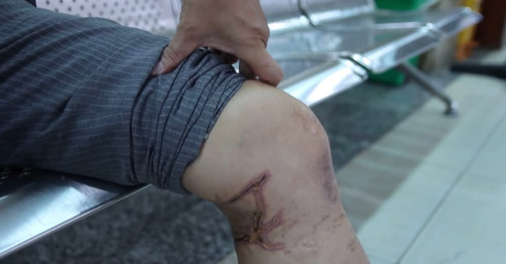 The patient was attacked by seaweed. Photo: Lan Anh